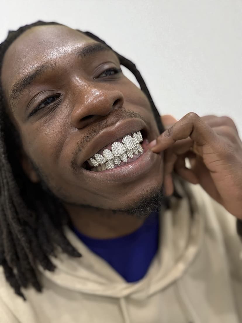 Grillz kép 3